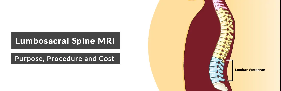 Lumbosacral Spine MRI: Purpose, Procedure, Cost and Best MRI Centre
